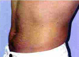 After Image: Patient # 56482 - front