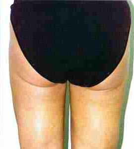 After Image: Patient # 32499 - front