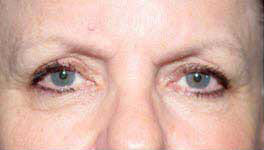 Before Image: Patient # 77178 - 