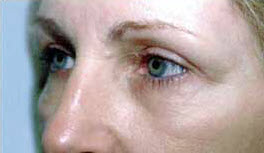 After Image: Patient # 63662 - 