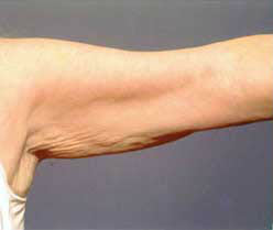 Before Image: Patient # 48406 - front