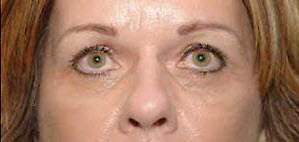 After Image: Patient # 19441 - 