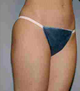 After Image: Patient # 56767 - front