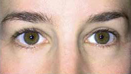 After Image: Patient # 33507 - 