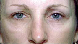 After Image: Patient # 63662 - 