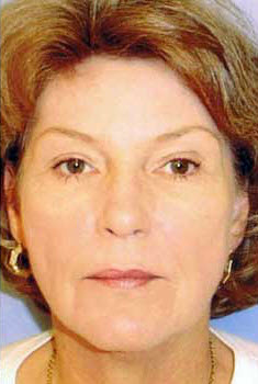 After Image