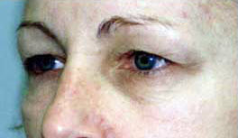 Before Image: Patient # 63662 - 