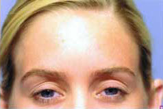 After Image: Patient # 59963 - front