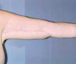 After Image: Patient # 48406 - front