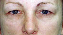 Before Image: Patient # 63662 - 