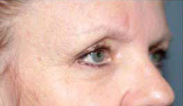 Before Image: Patient # 77178 - 