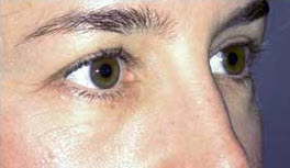 After Image: Patient # 33507 - 