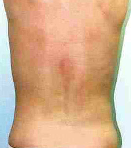 After Image: Patient # 55828 - front