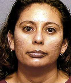 Before Image: Patient # 48035 - front