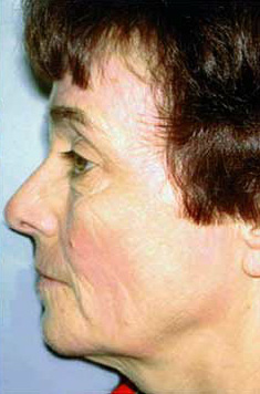 After Image