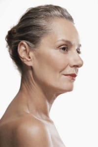 Neck Lift