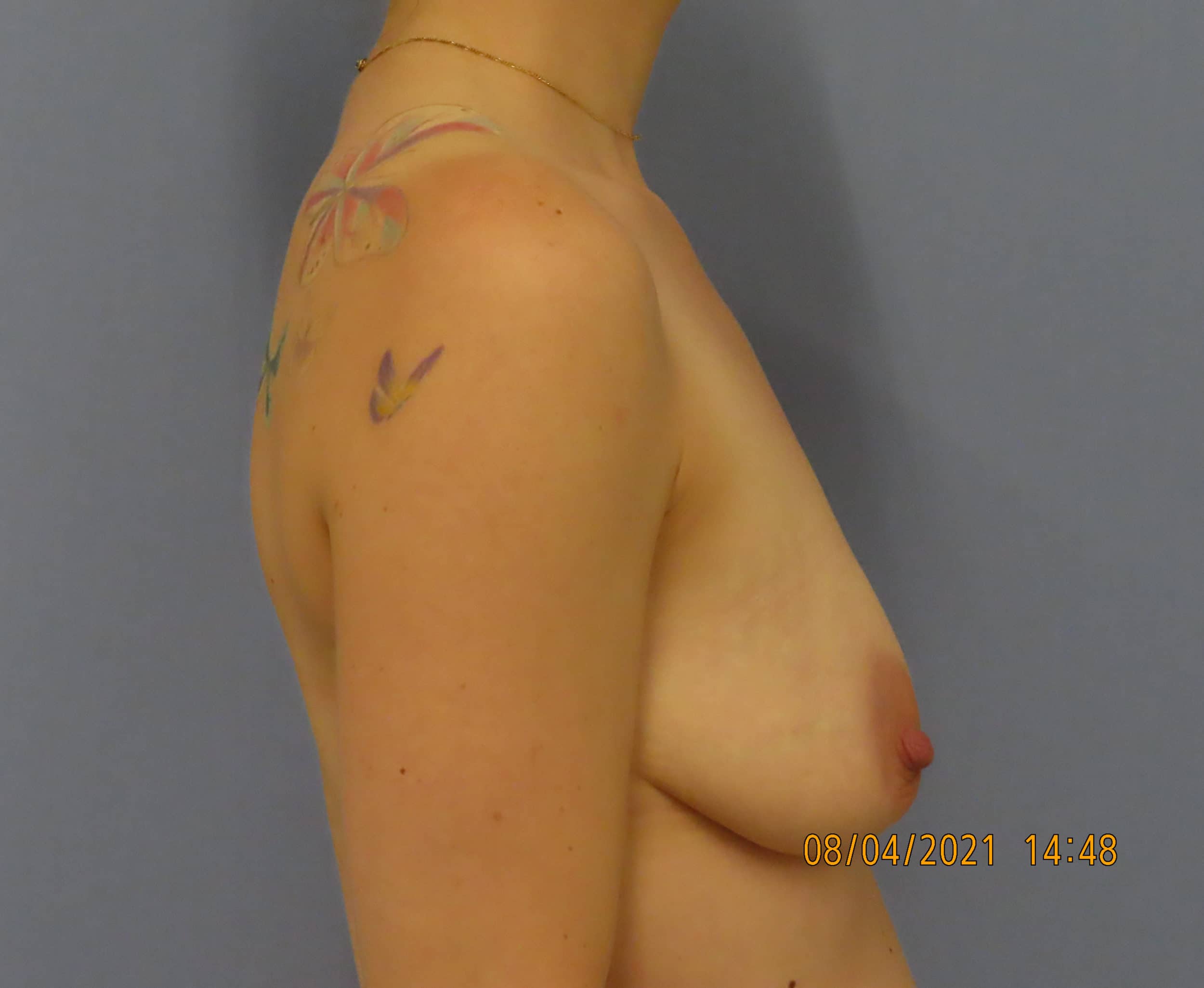 Before Image
