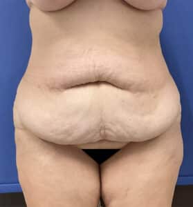 Before Image: Patient # 4597