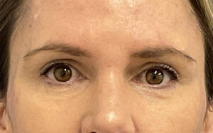 After Image: Patient # 4916