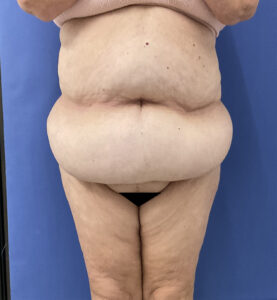 Before Image: Patient # 5082