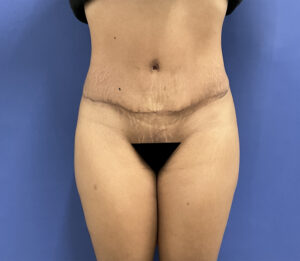 After Image: Patient # 5092