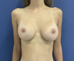 After Image: Patient # 5262