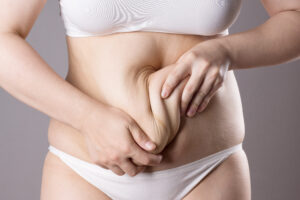 Mom holding her stomach and wanting a mommy makeover with fat transfer to slim her postpartum body