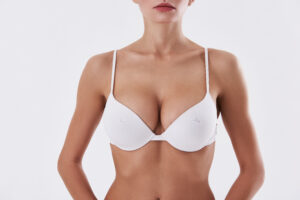 Woman's breasts in a white bra after breast augmentation to correct asymmetry in La Jolla, CA
