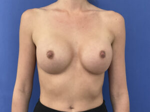 After Image: Patient # 5491